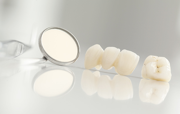 白い被せ物・詰め物