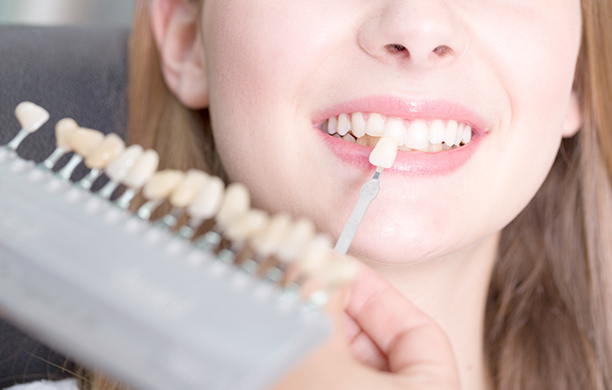 ホワイトニング