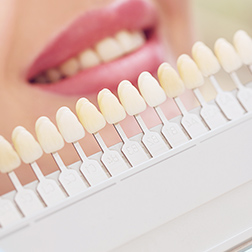 審美的歯科治療