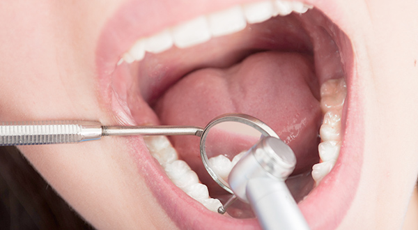 初期治療・再評価・確定的外科処置および矯正・再評価