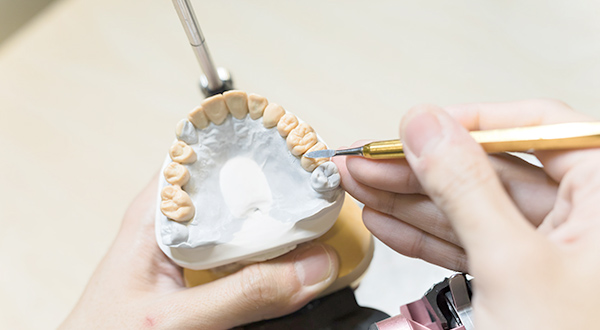 最終補綴物の製作