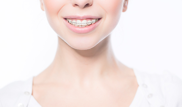 成人の矯正歯科